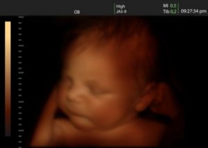 12639583 - image of newborn baby like 3d ultrasound of baby in mother s womb